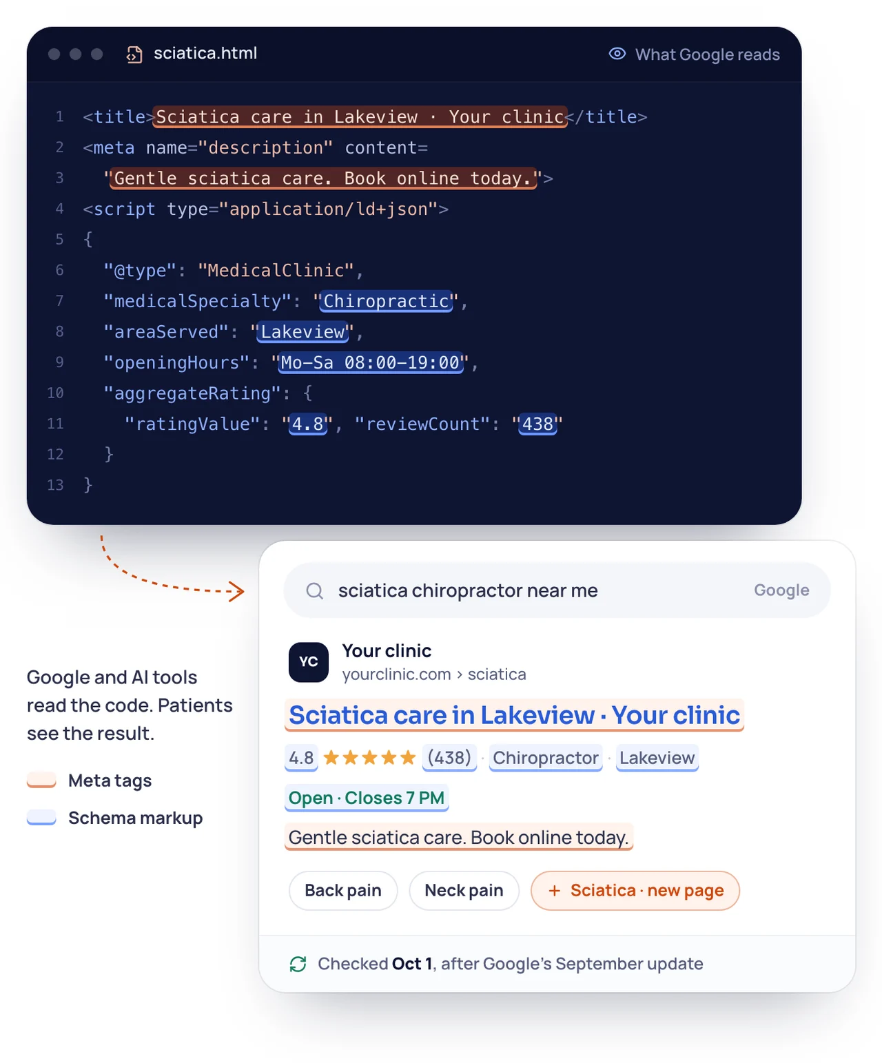 A sciatica page's code above the Google result it makes for "sciatica chiropractor near me": the page title and description (meta tags) and the clinic's specialty, town, opening hours and 4.8 stars from 438 reviews (schema markup) are marked in the same colors in both.
